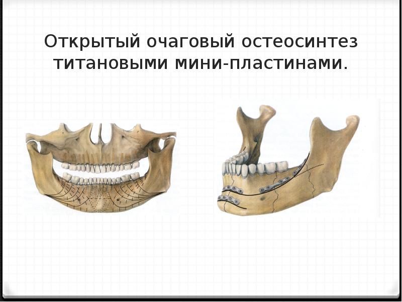 Комбинированные повреждения чло презентация