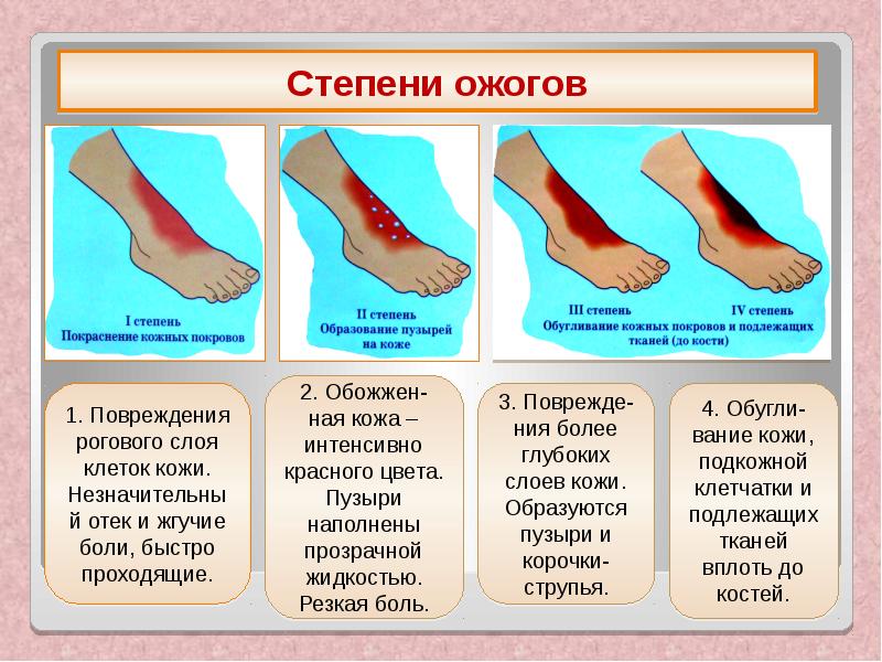 Гангрена стопы карта вызова скорой медицинской