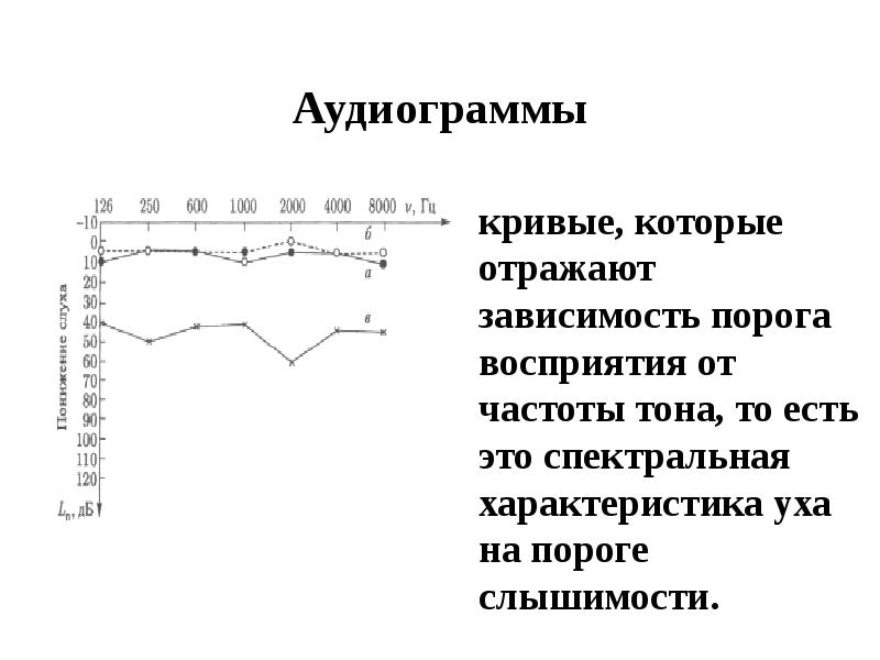Аудиограммы