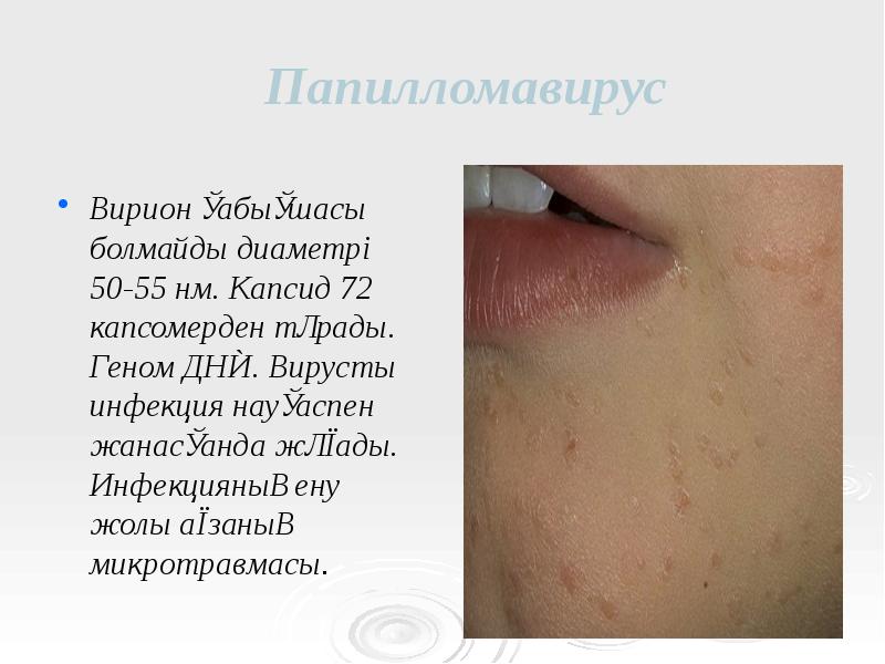 Папилломавирус
Вирион қабықшасы болмайды диаметрі 50-55 нм. Капсид 72 капсомерден тұрады. Папилломавирус
Вирион қабықшасы болмайды диаметрі 50-55 нм. Капсид 72 капсомерден тұрады.