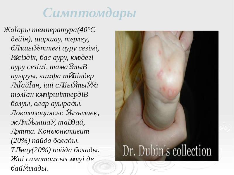 Симптомдары
Жоғары температура(40°С дейін), шаршау, терлеу, бұлшықеттегі ауру сезімі, әлсіздік, бас Симптомдары
Жоғары температура(40°С дейін), шаршау, терлеу, бұлшықеттегі ауру сезімі, әлсіздік, бас