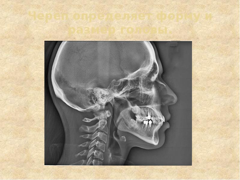 Череп определяет форму и размер головы.