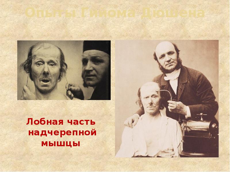 Опыты Гийома Дюшена