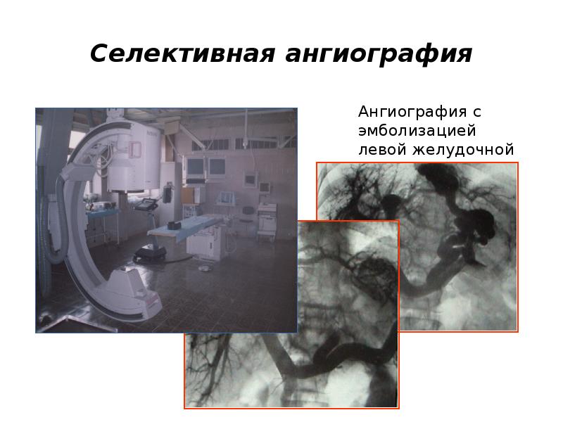 Желудочное кровотечение карта вызова скорой