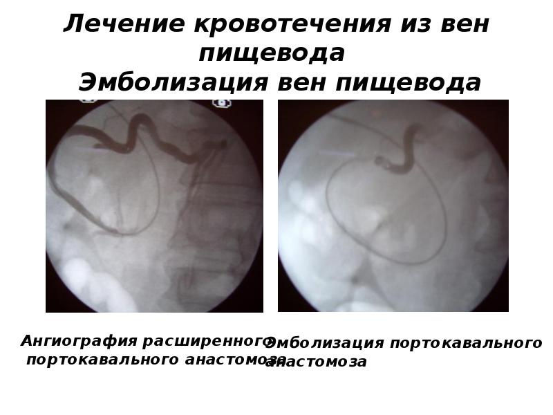 Методы диагностики кровотечения