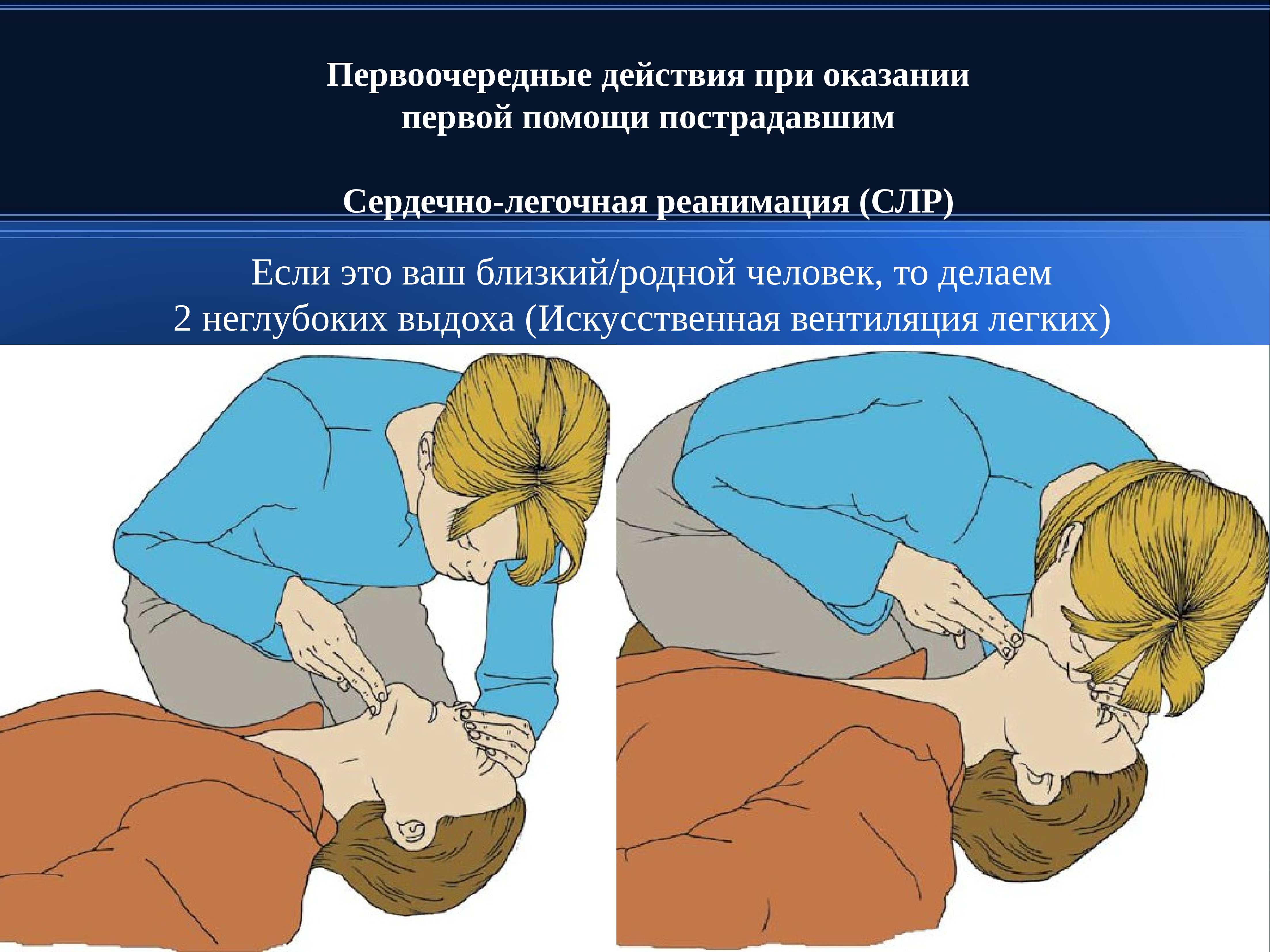 Каким образом проводится легочная реанимация пострадавшего. Сердечно-лёгочная реанимация. Первоочередное действие при оказании первой помощи. Первоочередные действия при оказании помощи пострадавшим. Первоочередным при реанимации?.