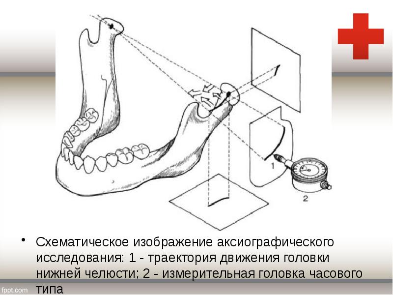 Второй челюстной стол