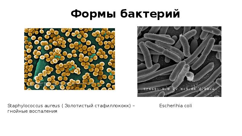 Среди бактерий встречаются. Форма бактерии стафилококки. Микоплазмы и стафилококки относятся к царству.