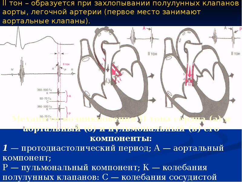 Аорто легочная коллатераль