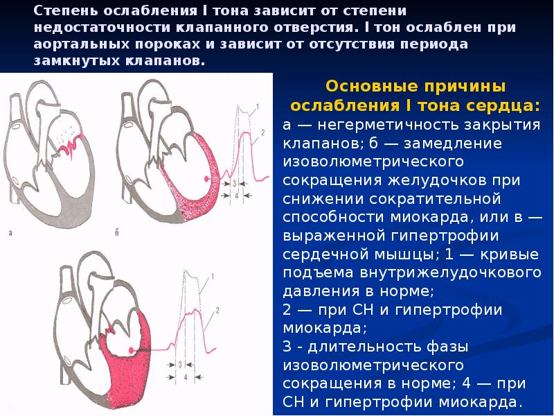 Презентация пороки сердца пропедевтика