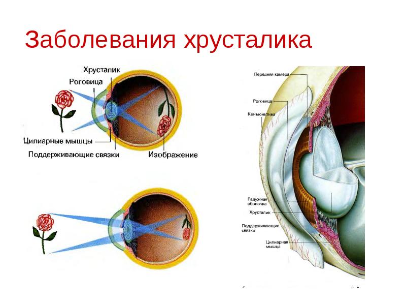 Заболевания век конъюнктивы и слезных органов презентация