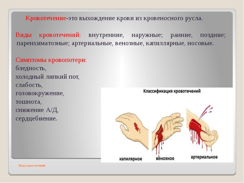 Виды кровотечения у человека. Артериальное венозное и капиллярное кровотечение. Наружные и внутренние кровотечения. Артериальное кровотечение и венозном кровотечении.
