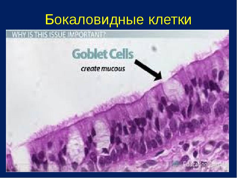 Бокаловидные клетки. Бокаловидная клетка гистология. Бокаловидные клетки морфология. Бокаловидные клетки синтезируют. Бокаловидные клетки легких.