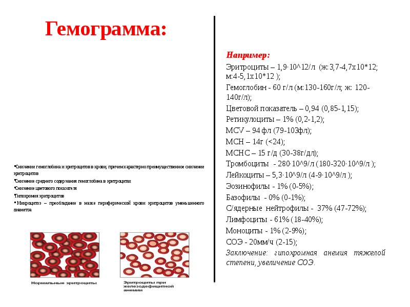 Панмиелофтиз картина крови