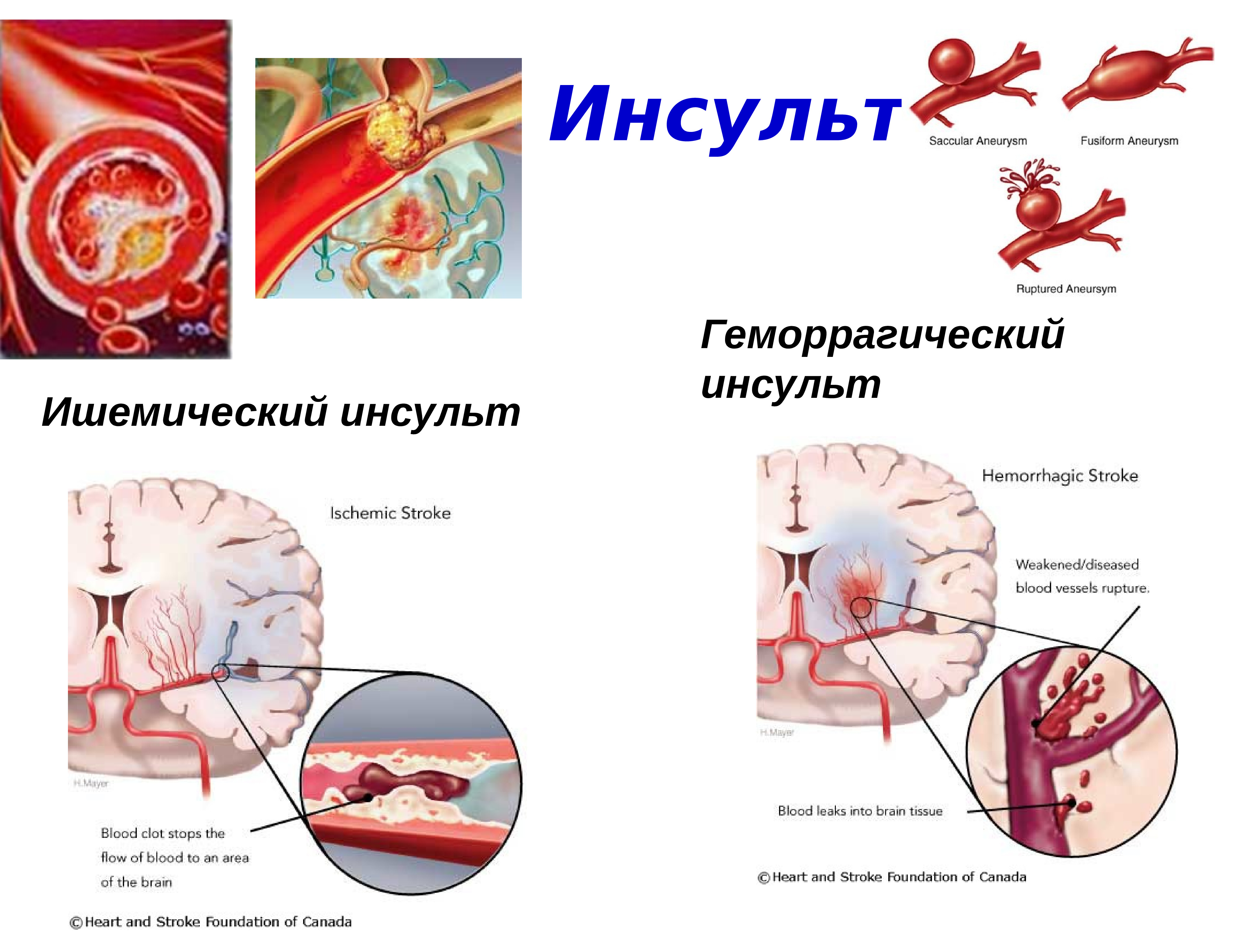 Презентация на тему лфк при заболеваниях сердечно сосудистой системы