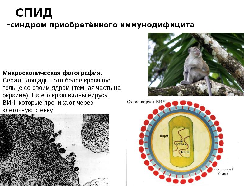 Презентация на тему испанский грипп