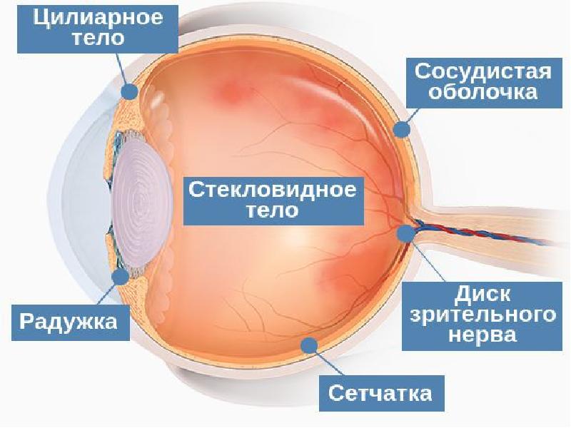 Заболевания сосудистой оболочки. Увеит (воспаление сосудистой оболочки глаза).. Увеит стекловидное тело. Болезнь Бехтерева увеит.