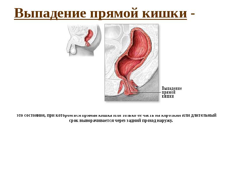 Анус После Первого Секса