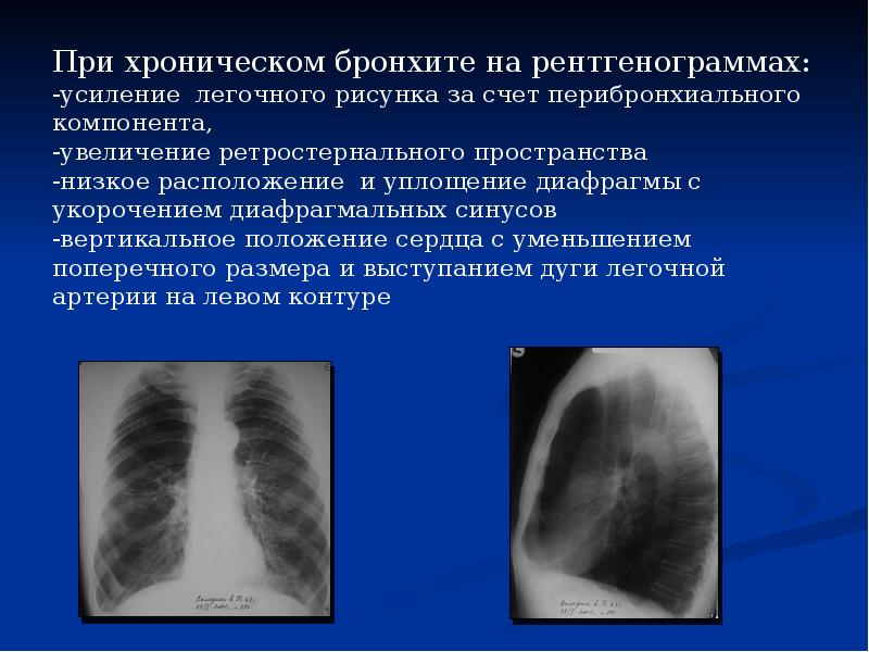 Характеристика изображений на рентгенограммах