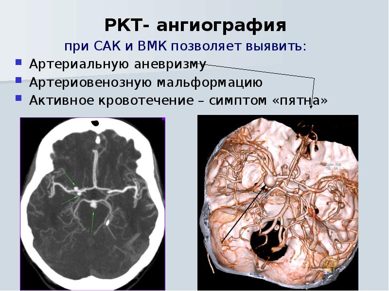 Сак кт картина