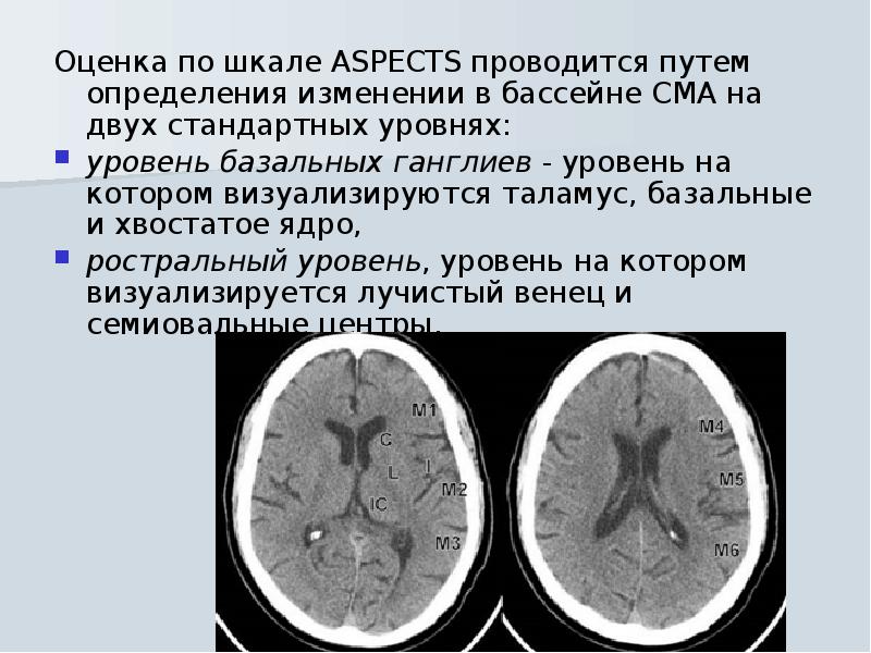 Онмк в бассейне сма. Онмк в бассейне сма