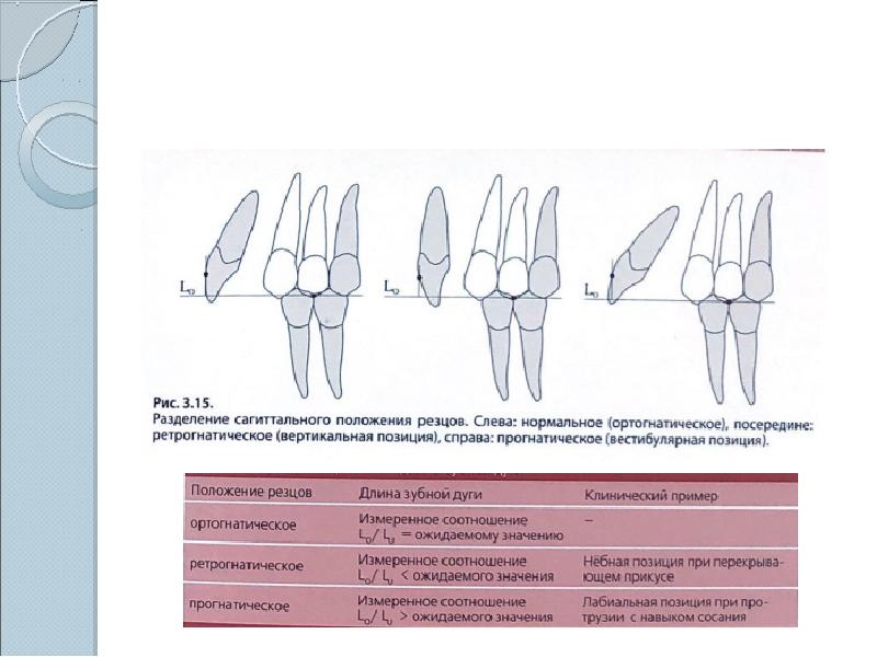 Современные методы диагностики в ортодонтии презентация