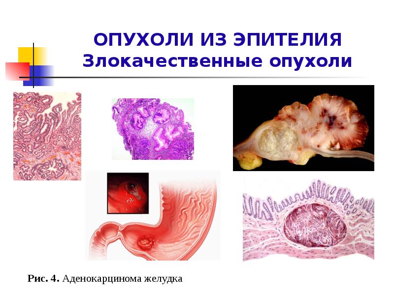 Презентация экстремальные состояния основы патологии