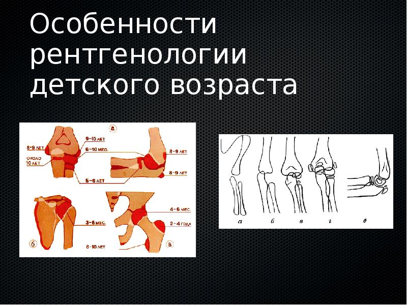 Амбулаторная травматология детского возраста презентация