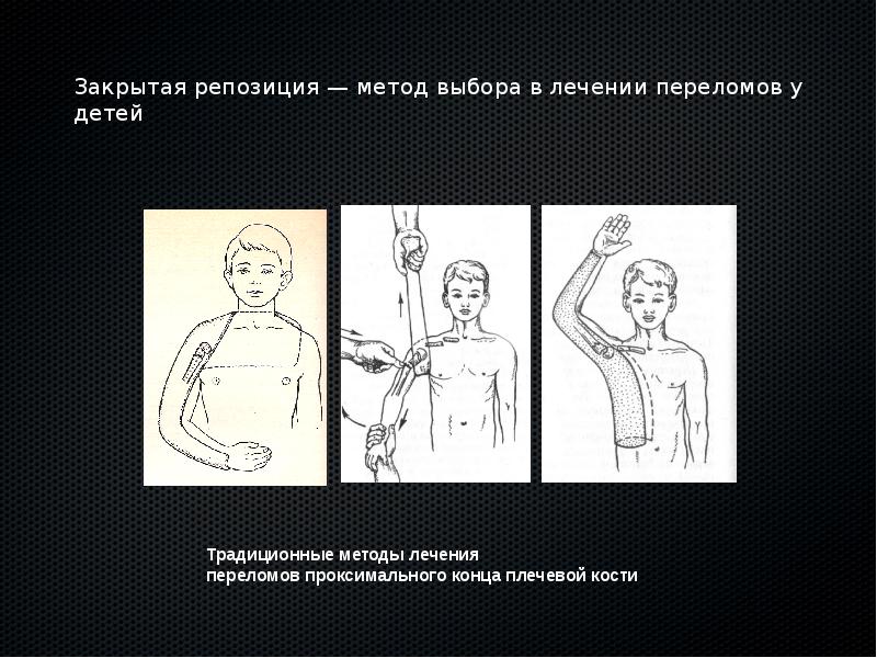 Амбулаторная травматология детского возраста презентация