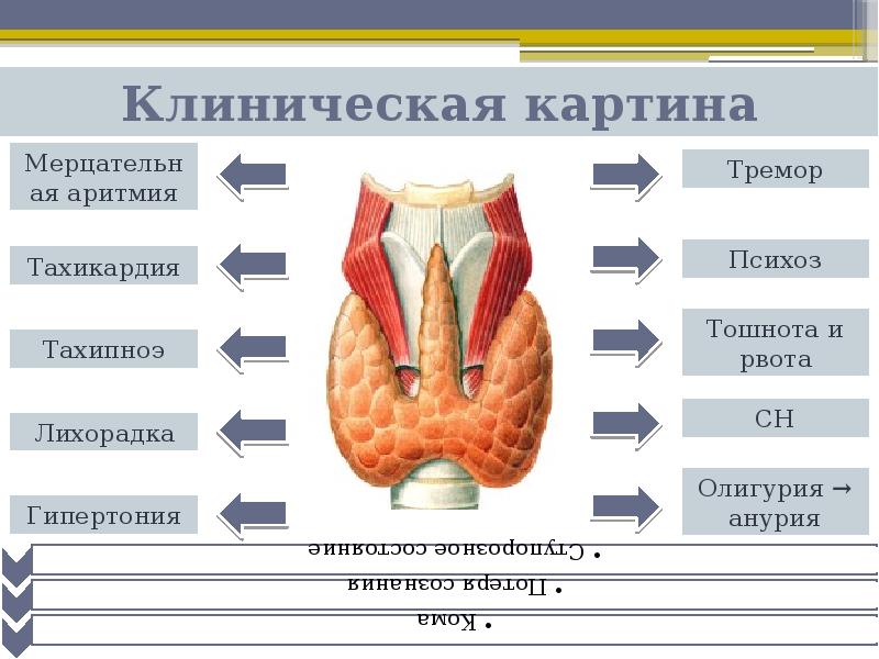 Клиническая картина тиреотоксического криза