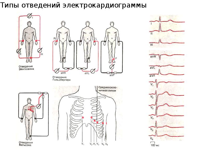 Картинка стандартные отведения