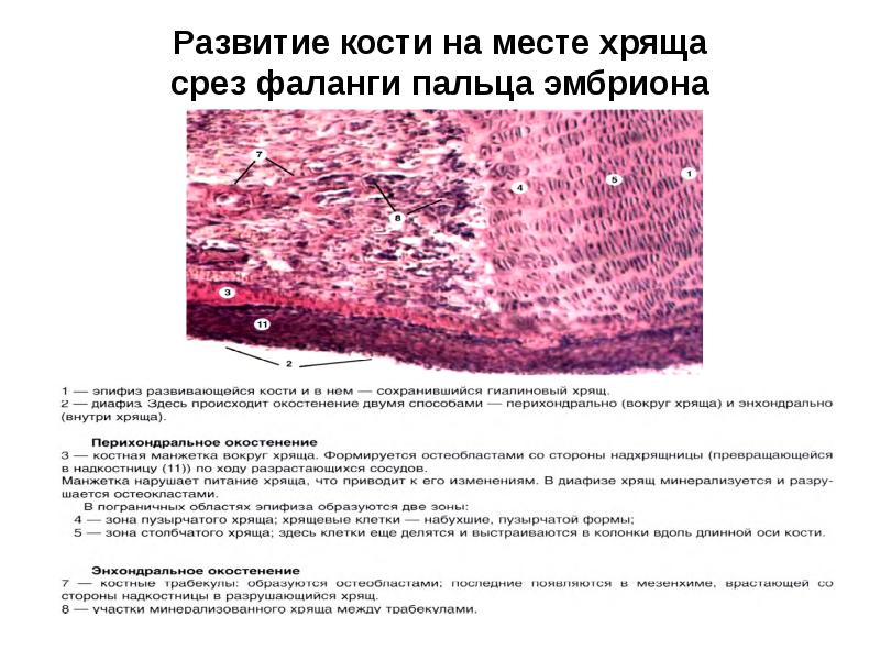 Развитие кости на месте хряща гистология рисунок