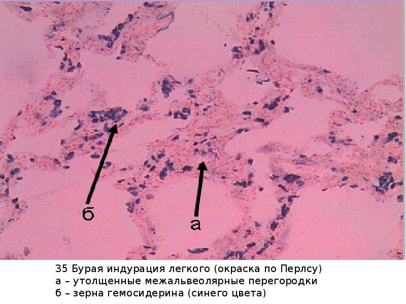 Реакция перлса