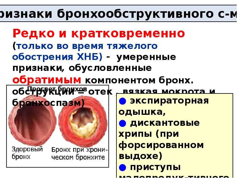 Признаки бронхита. Хронический бронхит презентация. Хронический бронхит и ХОБЛ. Признаки хронического бронхита.