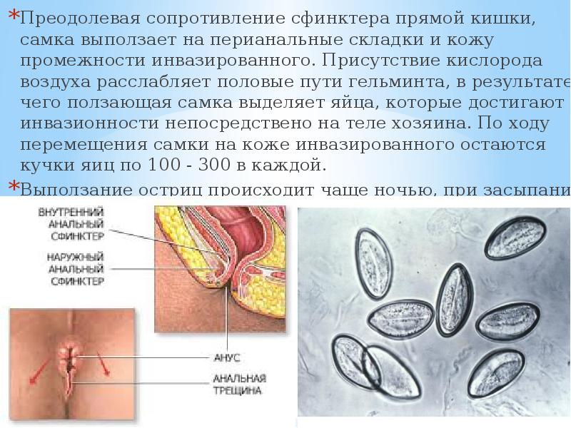 Анальные бахромки