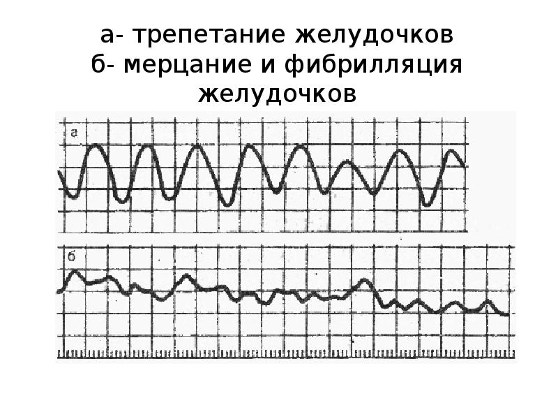 Математика в кардиологии презентация