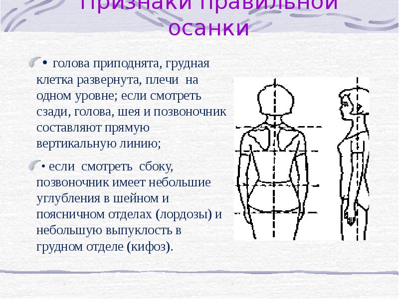 Признаки правильной жизни. Осанка человека. Признаки правильной осанки человека. Признаки неправильной осанки. Перечислите признаки правильной осанки..