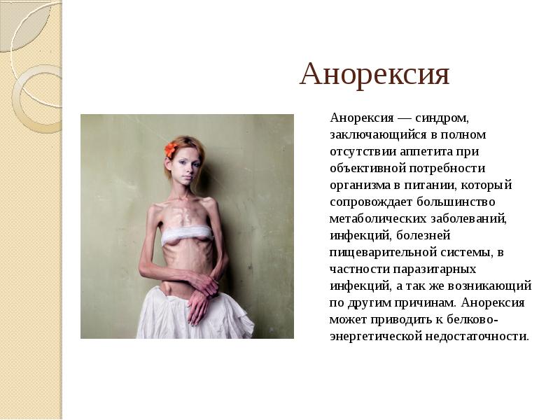 Анорексия Анорексия