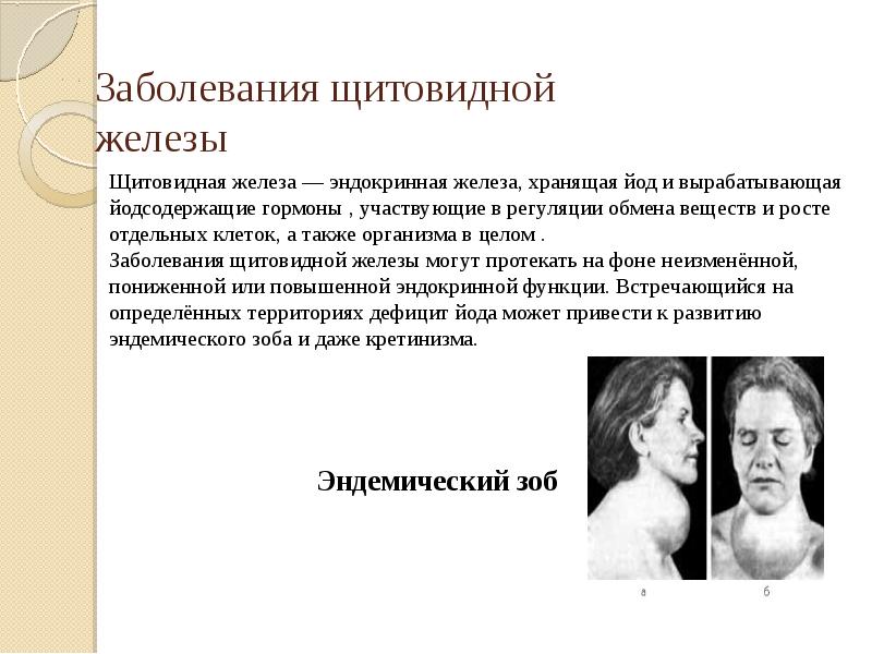 Заболевания щитовидной железы Заболевания щитовидной железы