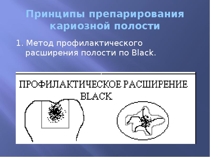 Принципы препарирования кариозной полости 1. Метод профилактического расширения полости по Black.