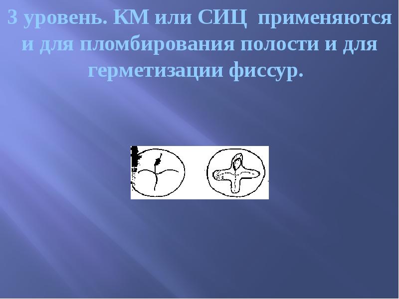 3 уровень. КМ или СИЦ применяются и для пломбирования полости и