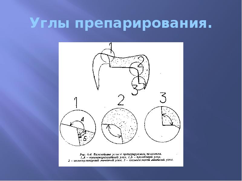 Углы препарирования.