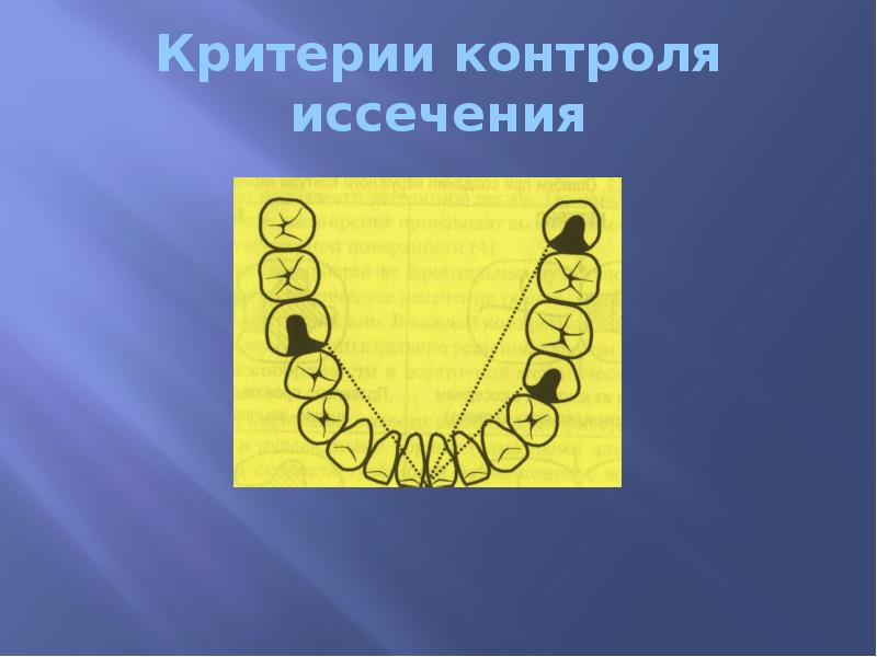 Критерии контроля иссечения