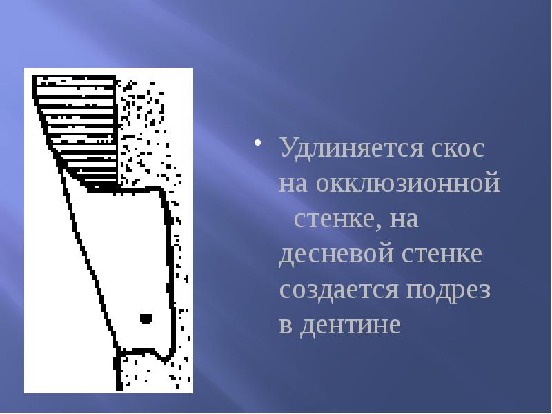 Удлиняется скос на окклюзионной  стенке, на десневой стенке создается подрез