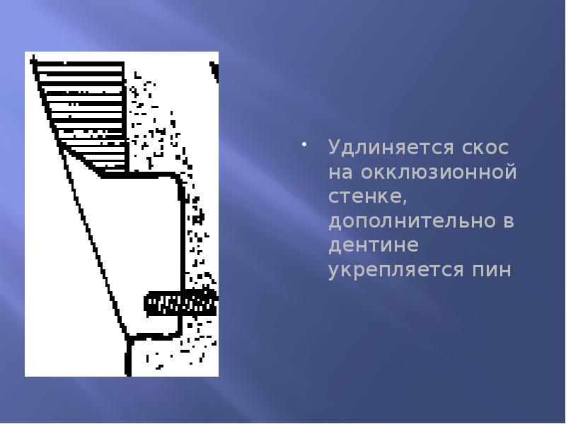 Удлиняется скос на окклюзионной стенке, дополнительно в дентине укрепляется пин Удлиняется