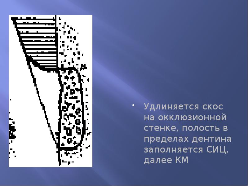 Удлиняется скос на окклюзионной стенке, полость в пределах дентина заполняется СИЦ,
