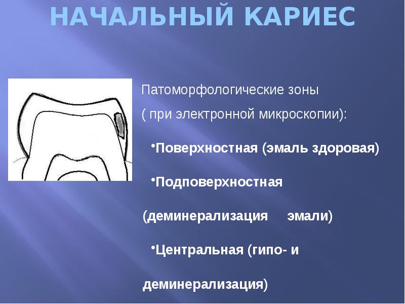 НАЧАЛЬНЫЙ КАРИЕС