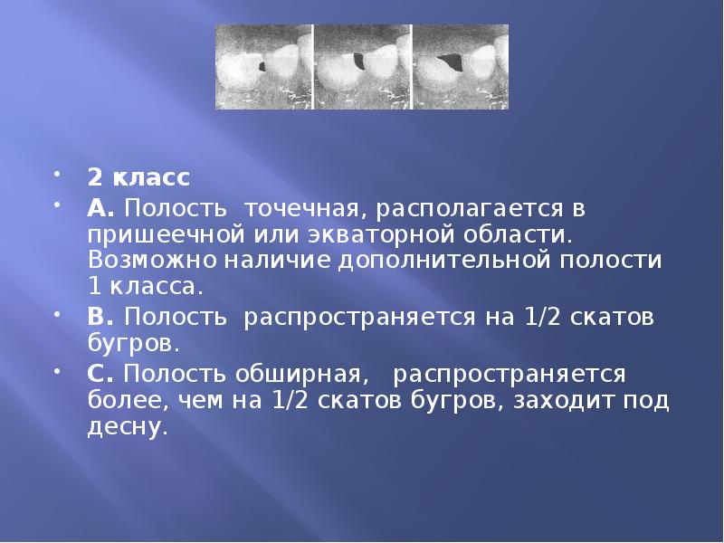 2 класс А. Полость точечная, располагается в пришеечной или экваторной области.