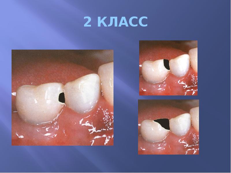 2 КЛАСС