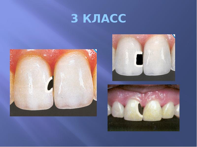 3 КЛАСС